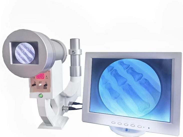 3.5-inch screen handheld fluoroscopy machine with monitor