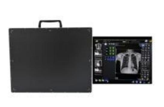 17&times;17 in flat panel detector with acquisition workstation